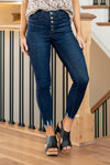 James Exposed Button Fly High Rise Ankle Skinny